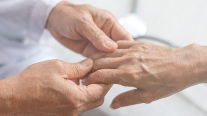 Doença de Parkinson