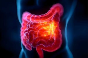 Tratar doenças intestinais