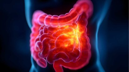 Tratar doenças intestinais